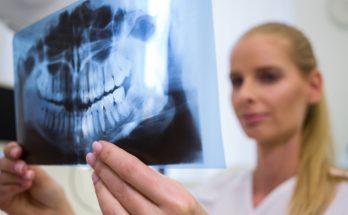 fogorvos röntgen