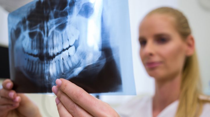 fogorvos röntgen